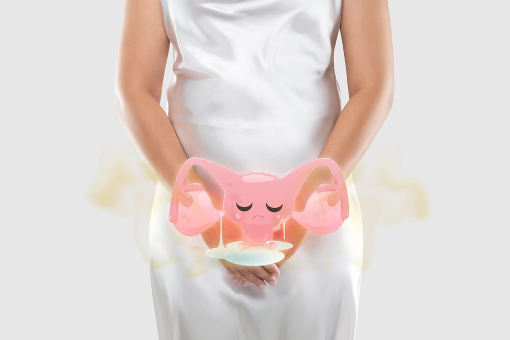  Vaginitis