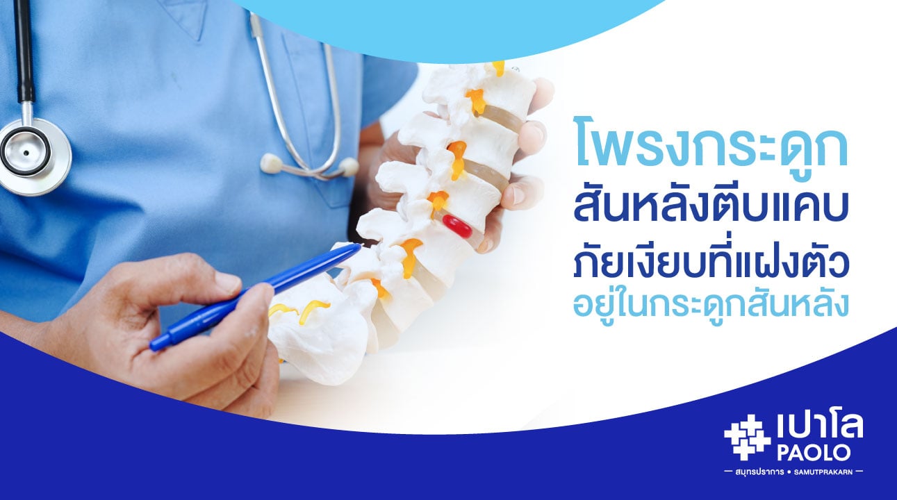 โพรงกระดูกสันหลังตีบแคบ...ภัยเงียบที่แฝงตัวอยู่ในกระดูกสันหลัง