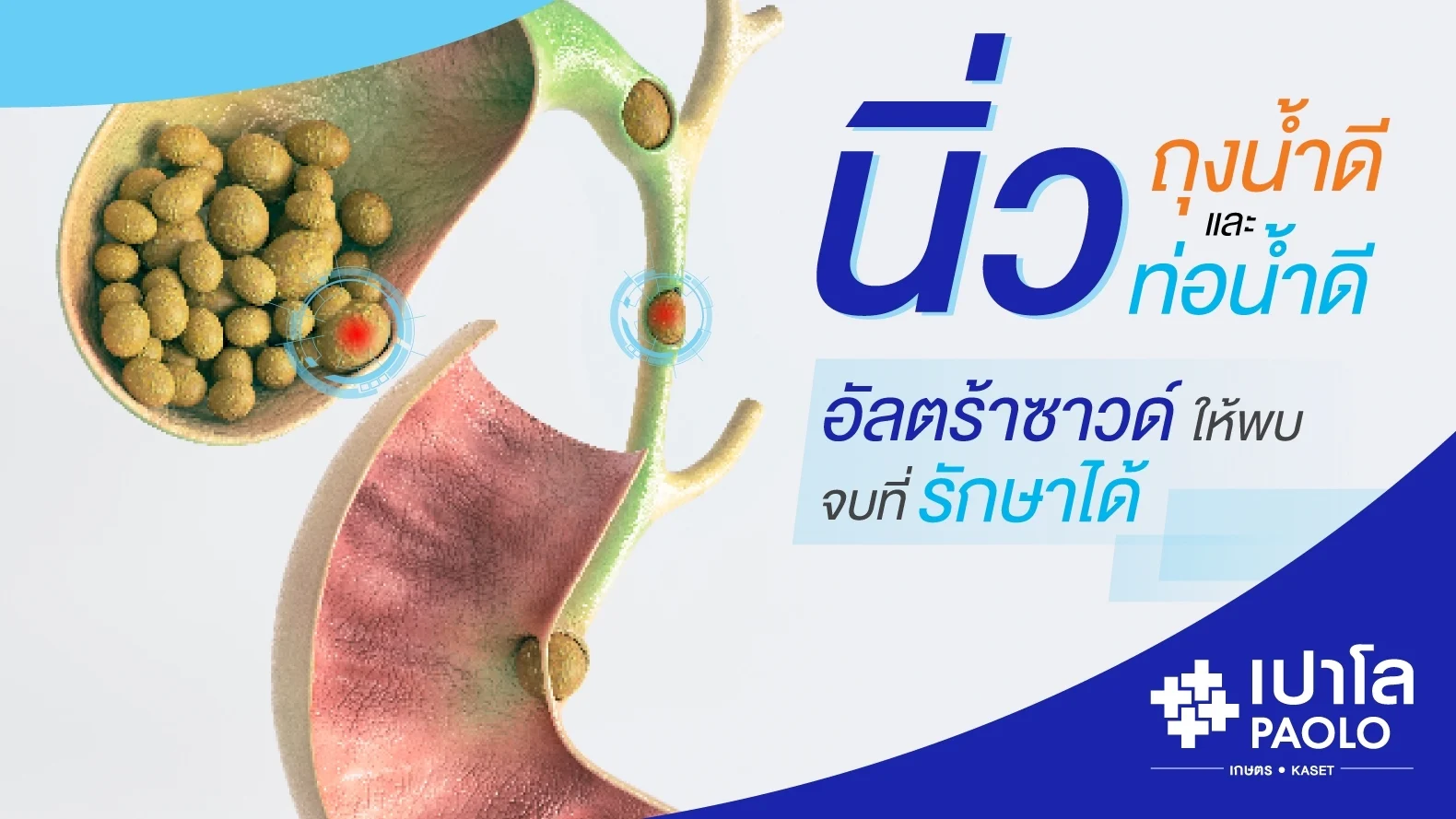 ปวดท้องต้องรู้ทัน อาการโรคนิ่วท่อน้ำดี