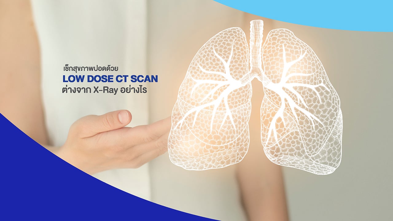 Low Dose CT scan ขั้นกว่าของการตรวจสุขภาพปอด 