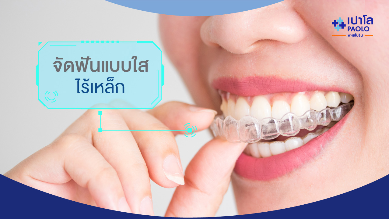 INVISALIGN จัดฟันแบบ "ใส" ไร้เหล็ก