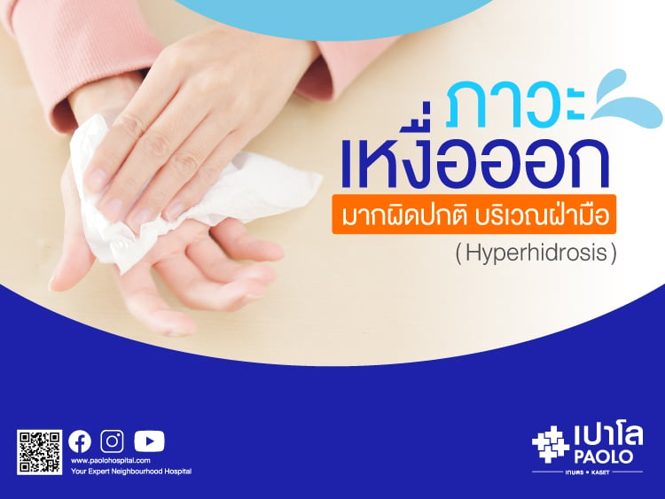 ภาวะเหงื่อออกมากผิดปกติ บริเวณฝ่ามือ (Hyperhidrosis)