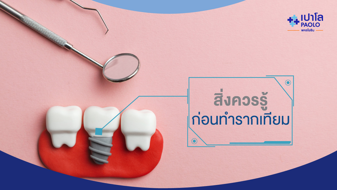 สิ่งควรรู้! ก่อนตัดสินใจทำรากฟันเทียม 