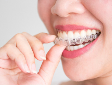 INVISALIGN จัดฟันแบบ "ใส" ไร้เหล็ก