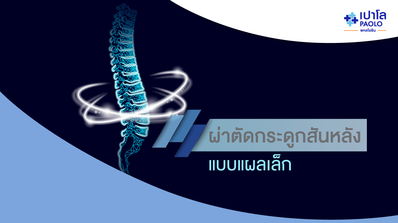 การผ่าตัดกระดูกสันหลังแบบแผลเล็ก