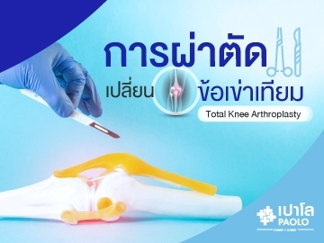 การผ่าตัดเปลี่ยนข้อเข่าเทียม Total knee arthroplasty