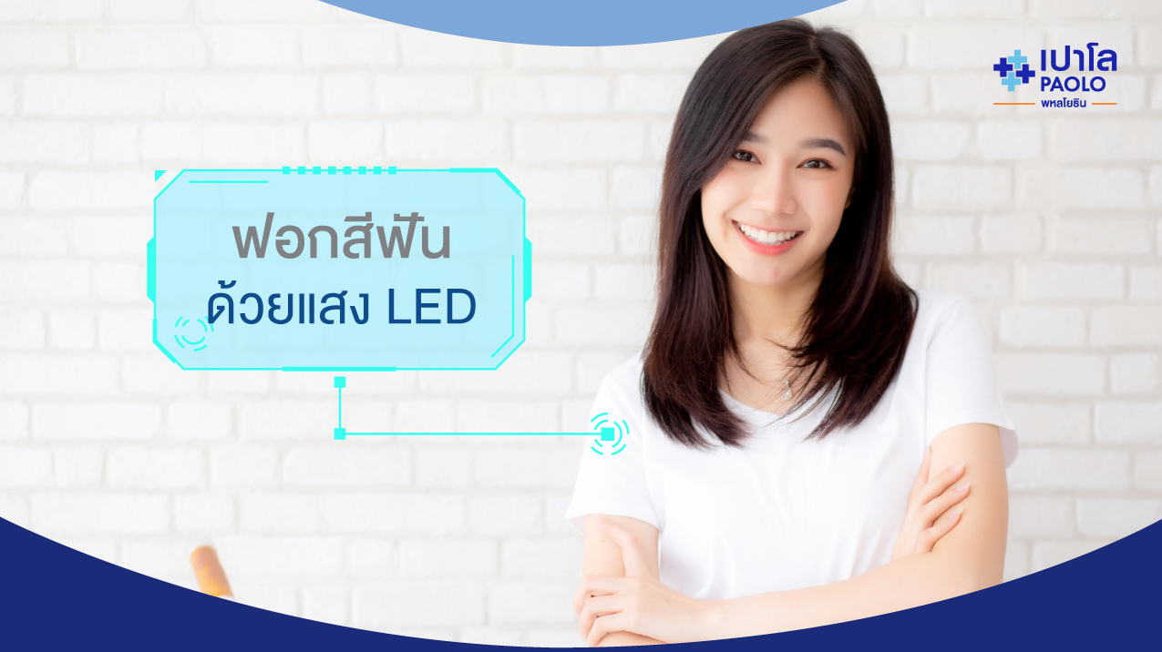 เทคโนโลยีการใช้แสง LED กระตุ้นการฟอกสีฟัน