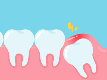 ทำไมเราต้องผ่าฟันคุด?