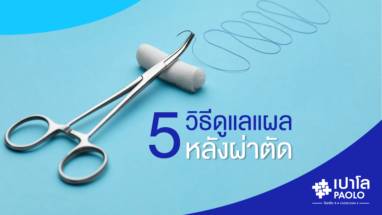 5 เทคนิค… วิธีดูแล “แผลผ่าตัด”