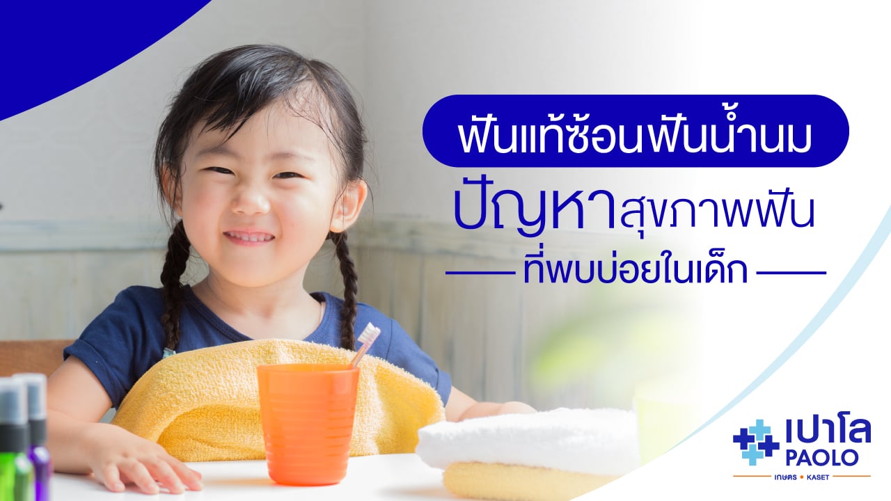 ฟันแท้ซ้อนฟันน้ำนม ปัญหาสุขภาพฟันที่พบบ่อยในเด็ก
