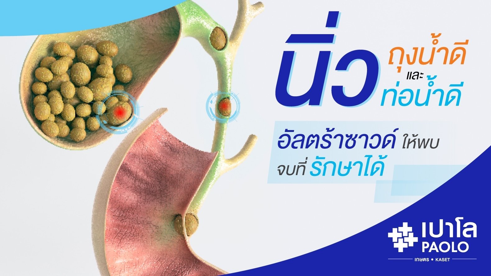 ปวดท้องต้องรู้ทัน อาการโรคนิ่วท่อน้ำดี