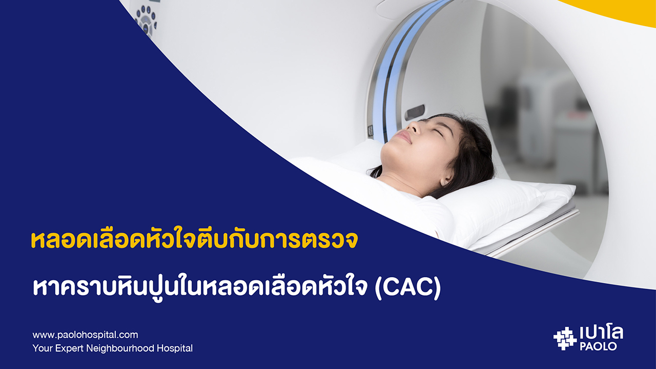 การตรวจหาคราบหินปูนในหลอดเลือดหัวใจ (CAC)