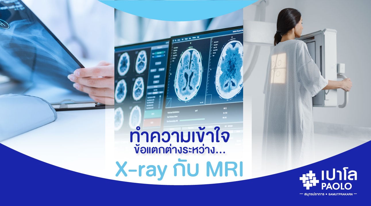 ทำความเข้าใจ...ข้อแตกต่างระหว่าง X-ray กับ MRI