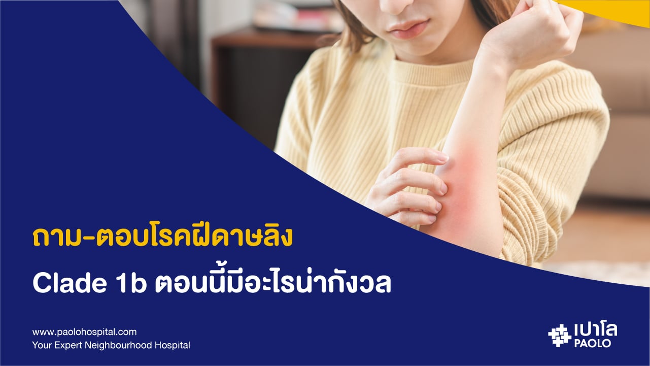 ถาม-ตอบโรคฝีดาษลิง Clade 1b ตอนนี้มีอะไรน่ากังวล