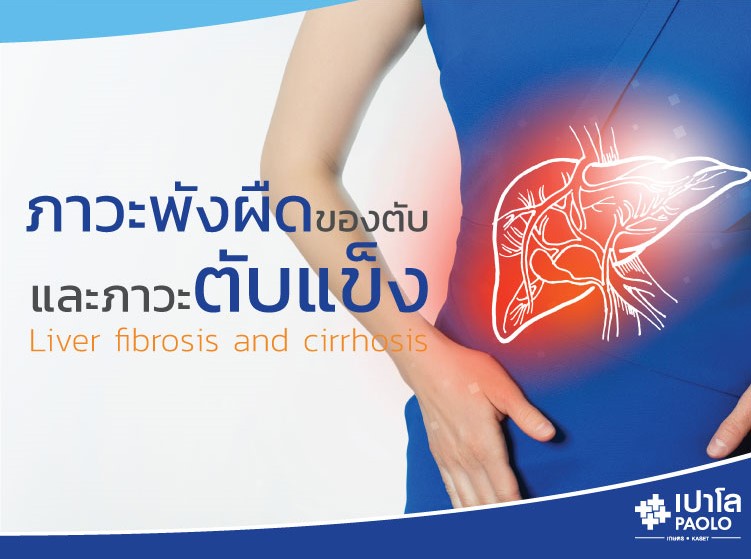 ภาวะพังผืดของตับ และภาวะตับแข็ง  (Liver fibrosis and cirrhosis)