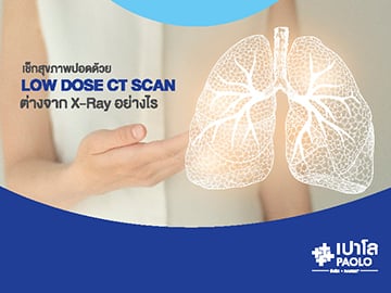 Low Dose CT scan ขั้นกว่าของการตรวจสุขภาพปอด 