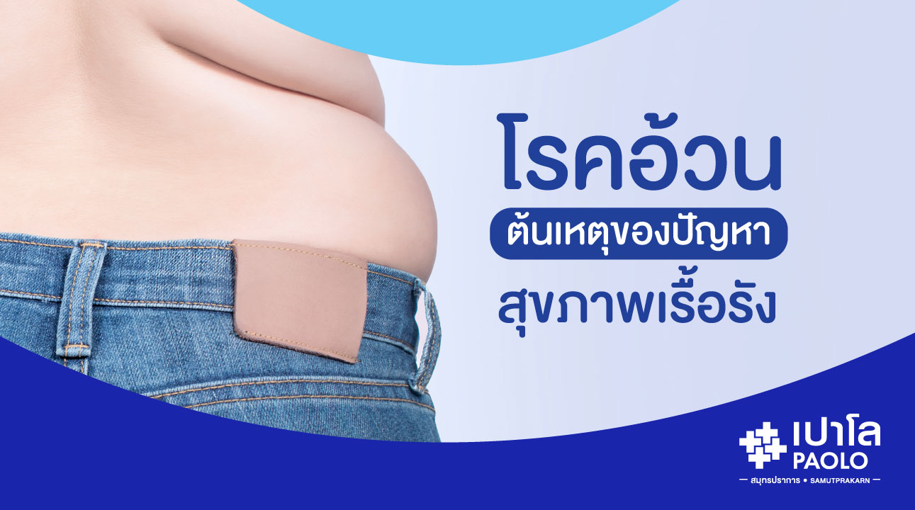 โรคอ้วน...ต้นเหตุของปัญหาสุขภาพเรื้อรัง