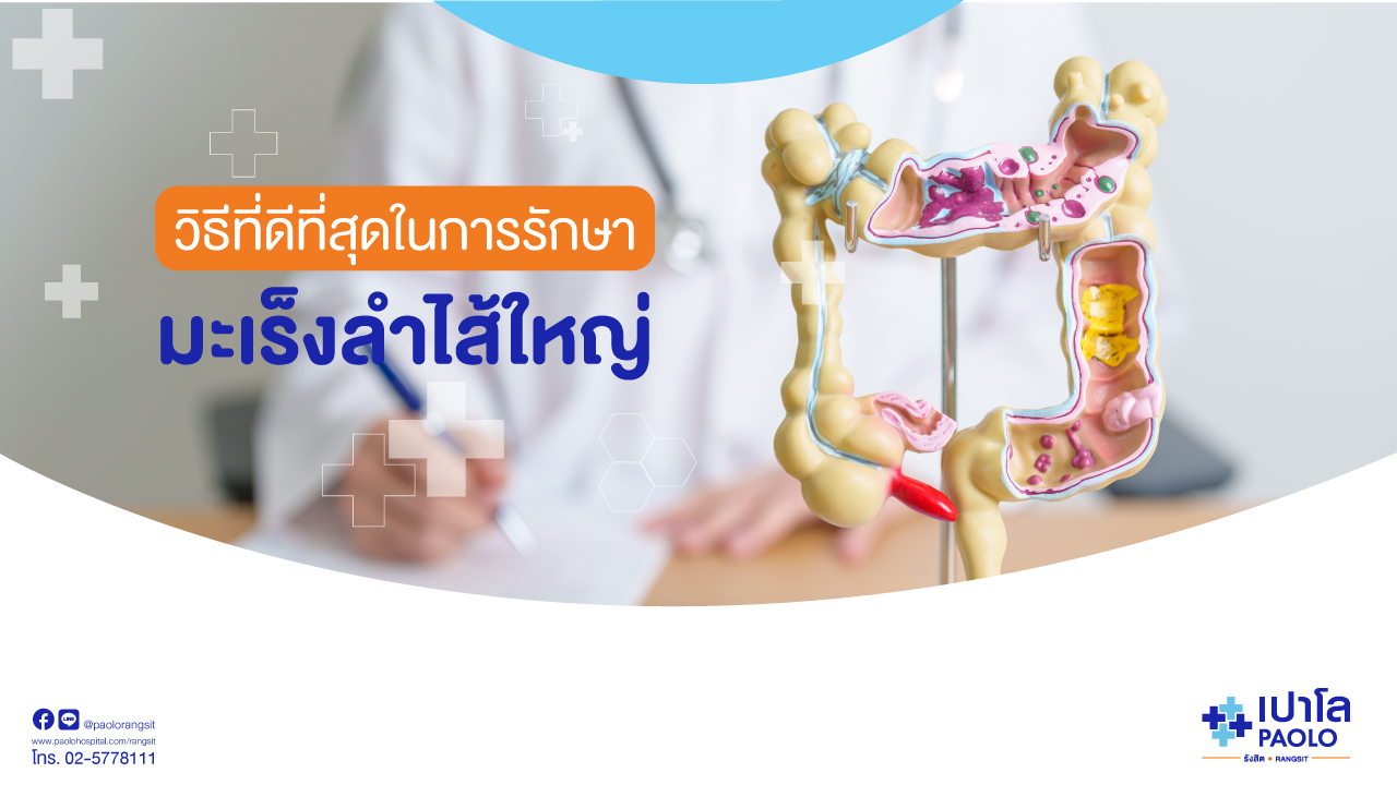 เมื่อการรักษามะเร็งลำไส้ใหญ่ ไม่ใช่เรื่องยากอย่างที่คิด