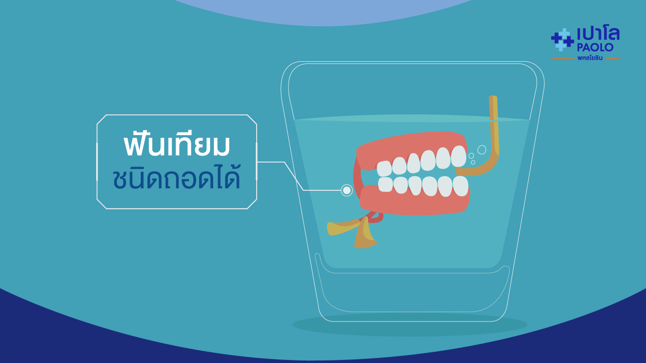 ฟันเทียมชนิดถอดได้ 