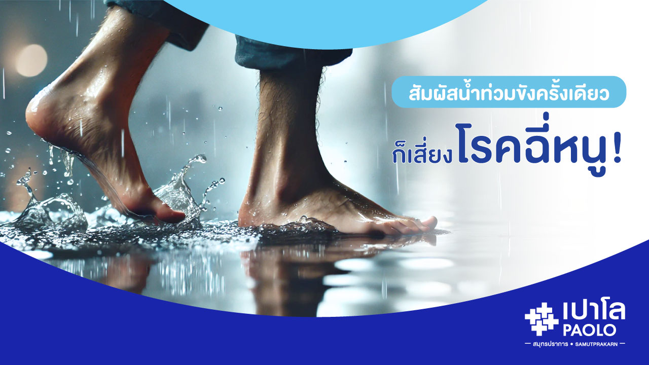 โรคฉี่หนู…แค่ลุยน้ำท่วมครั้งเดียว ก็เสี่ยงอันตราย!