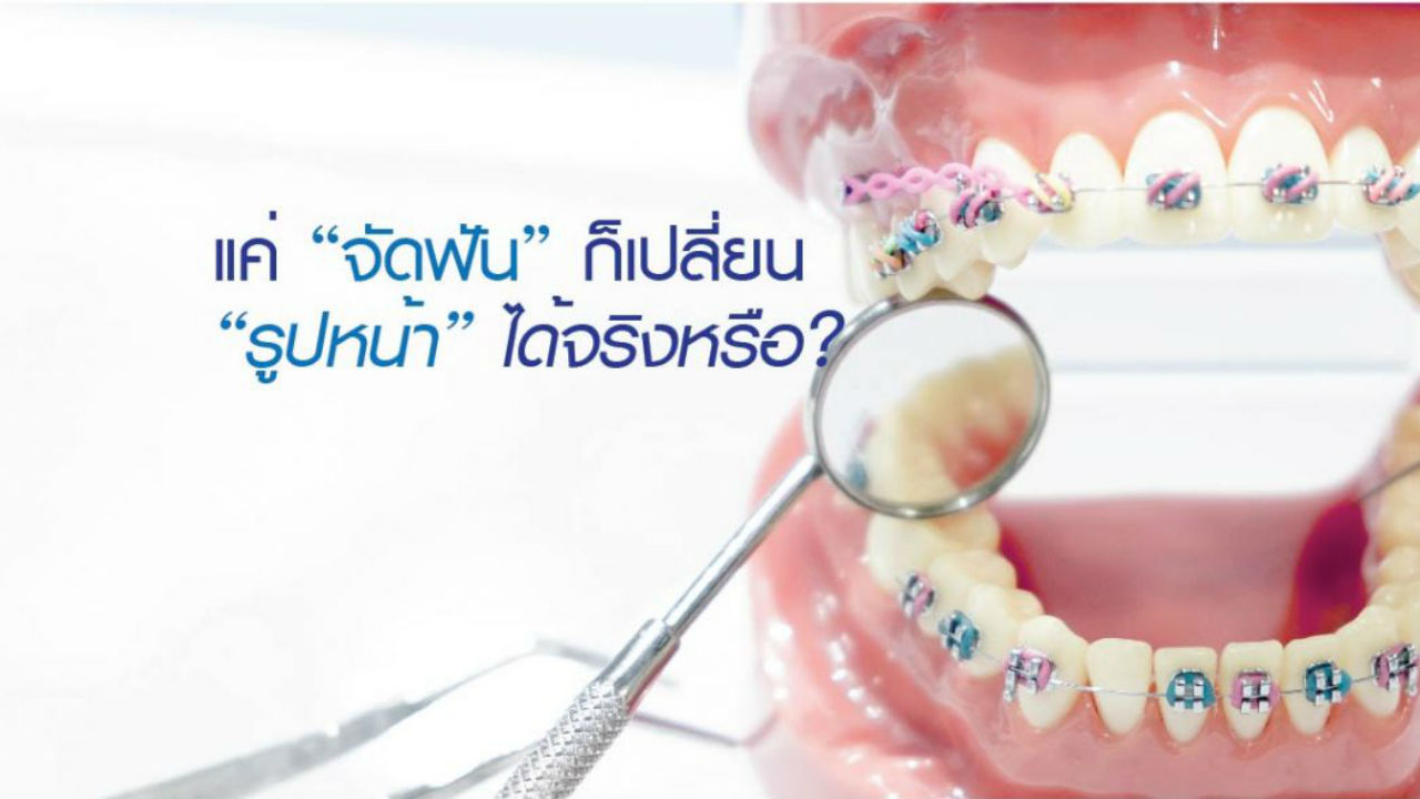 แค่ “จัดฟัน” ก็เปลี่ยน “รูปหน้า” ได้จริงหรือ?