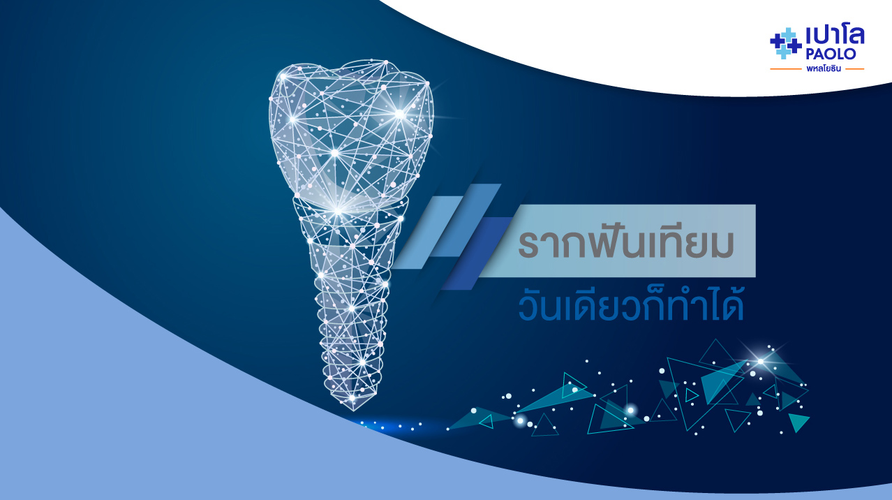 รากฟันเทียม วันเดียวก็ทำได้! ด้วยระบบดิจิตอล (ONE DAY IMPLANT)