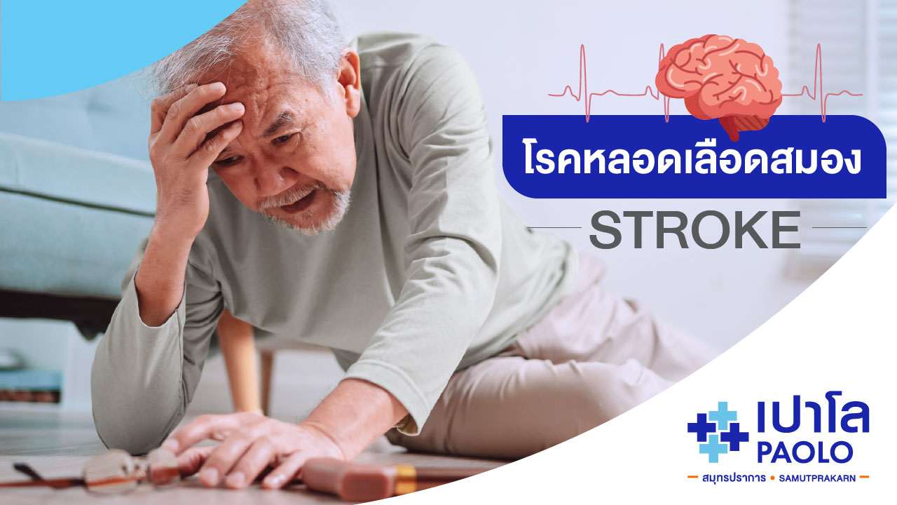 โรคหลอดเลือดสมอง (Stroke)