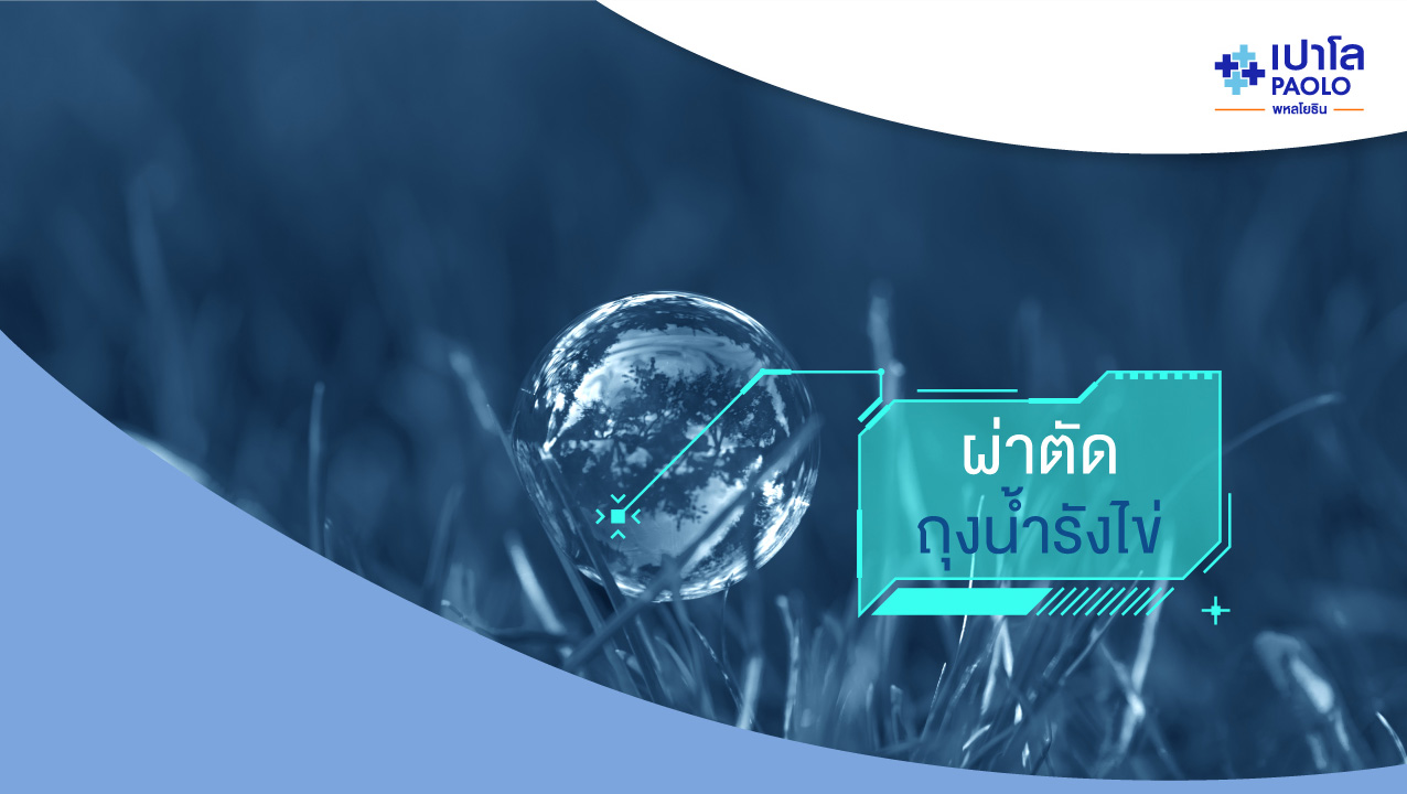 "ผ่าตัดถุงน้ำรังไข่" ไม่ใช่เรื่องน่ากลัว