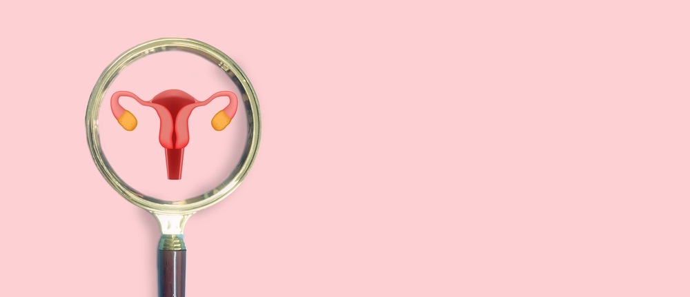 Cervical cancer