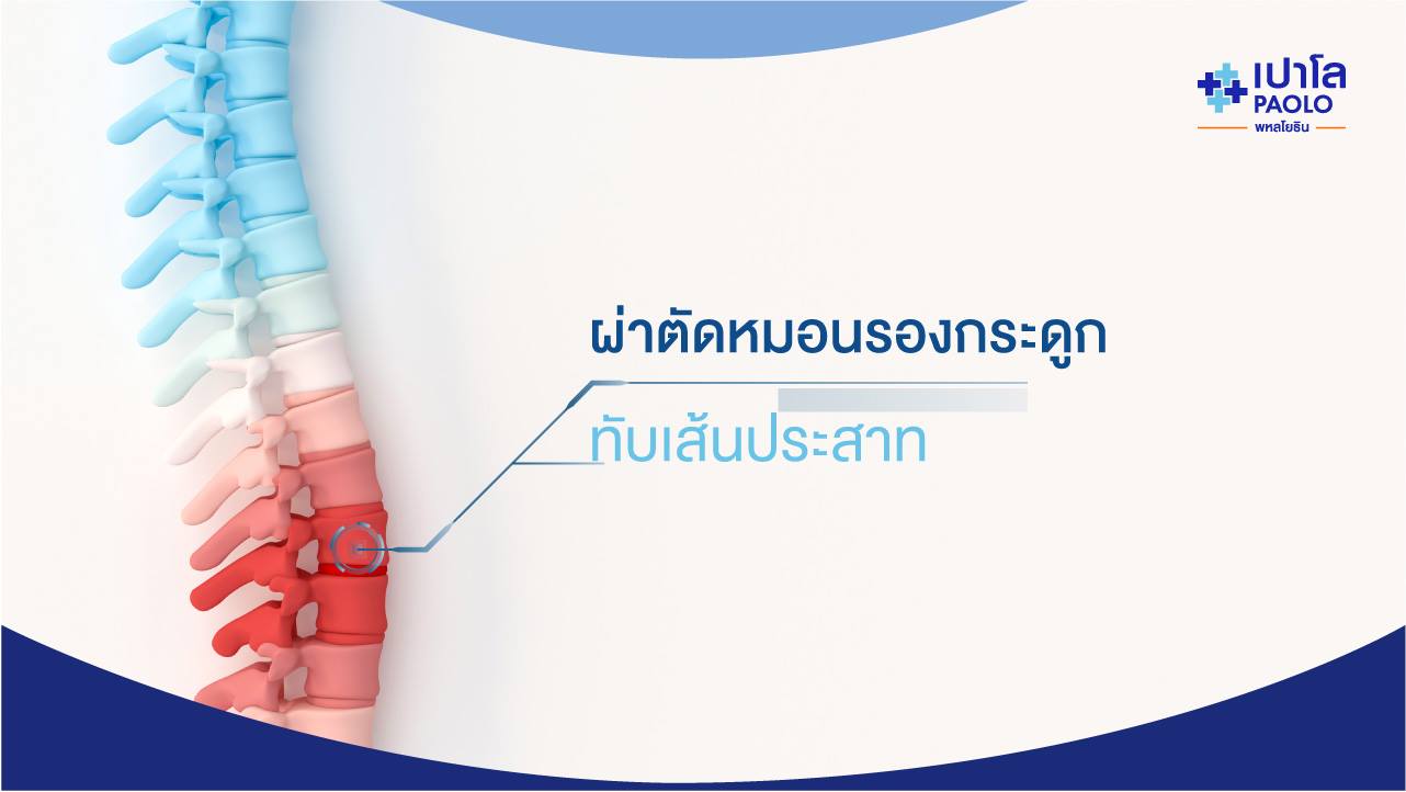 ผ่าตัดผ่านกล้องหมอนรองกระดูกทับเส้นประสาท