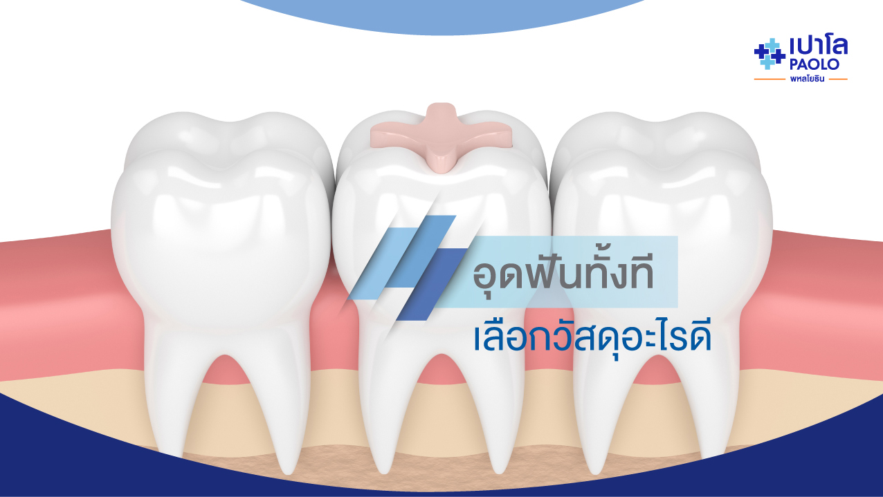 จะอุดฟันทั้งที เลือกวัสดุแบบไหนดีที่ตอบโจทย์