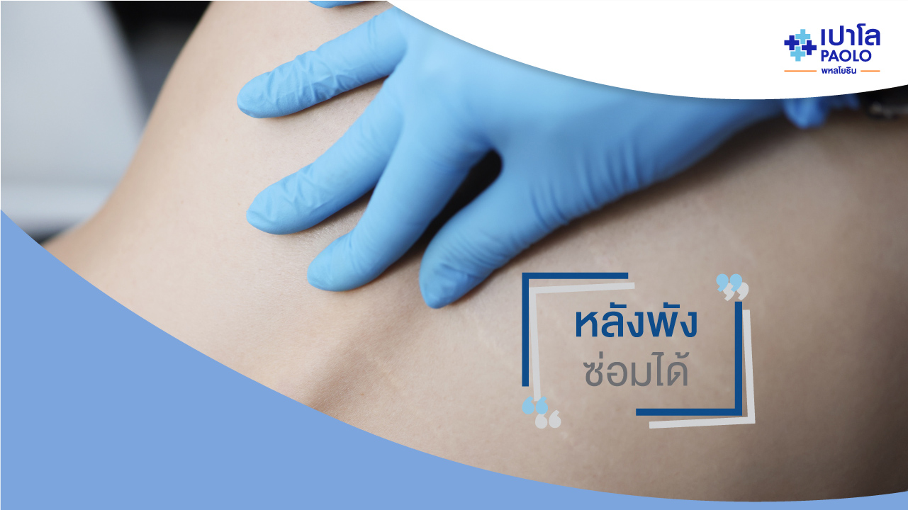 หลังพัง ซ่อมได้