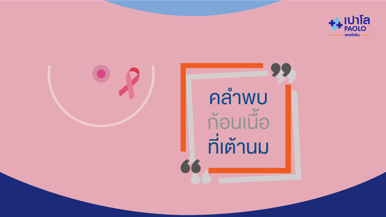 คลำพบ “ก้อนเนื้อที่เต้านม” กลิ้งได้ อันตรายแค่ไหน?