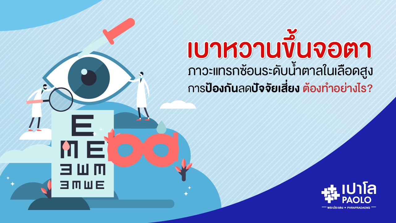 เบาหวานขึ้นจอตา