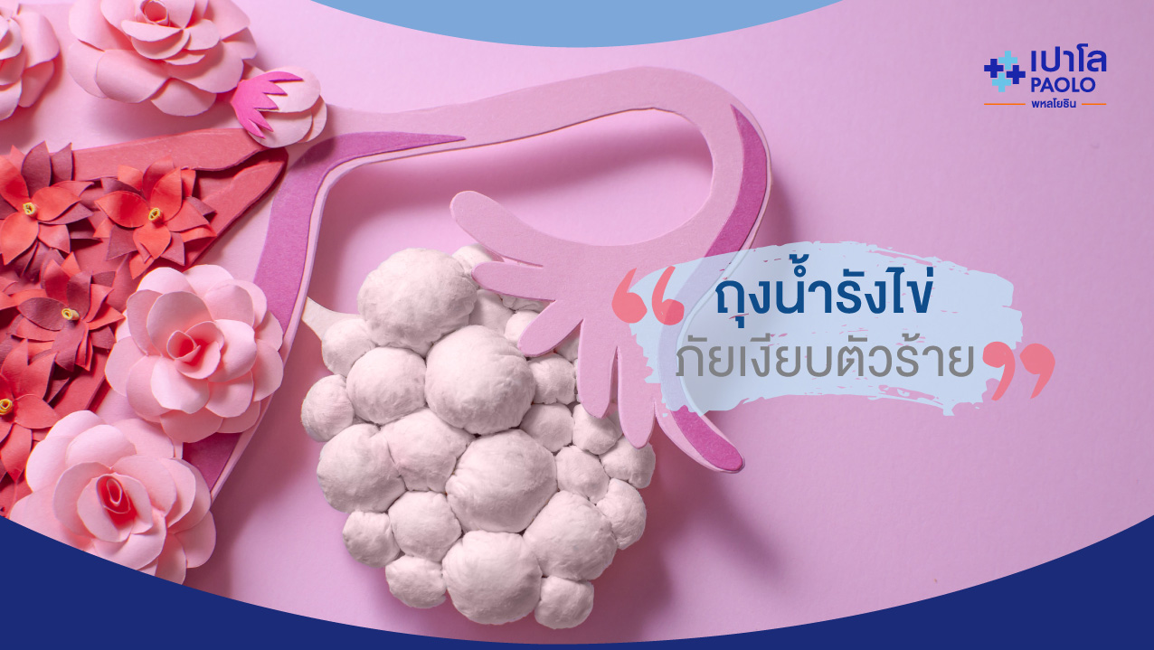 ถุงน้ำรังไข่ภัยเงียบตัวร้าย