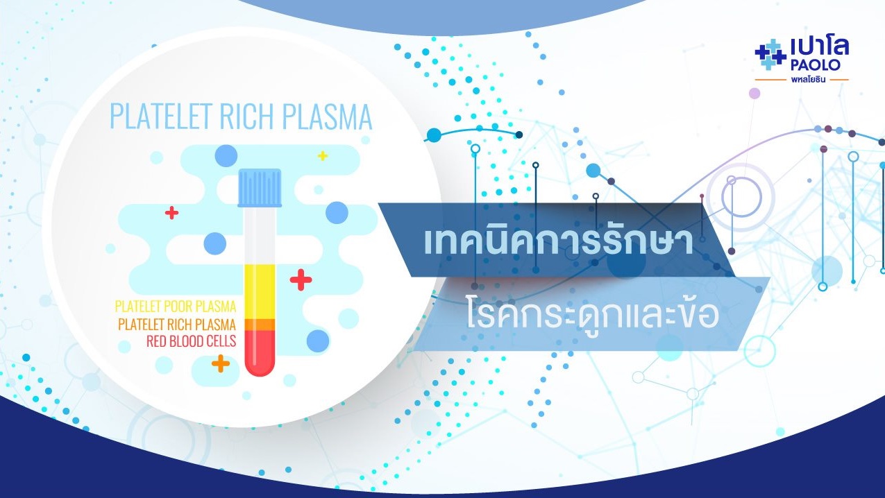 ฉีด PRP: Platelet Rich Plasma รักษาโรคทางกระดูก เอ็น และกล้ามเนื้อ