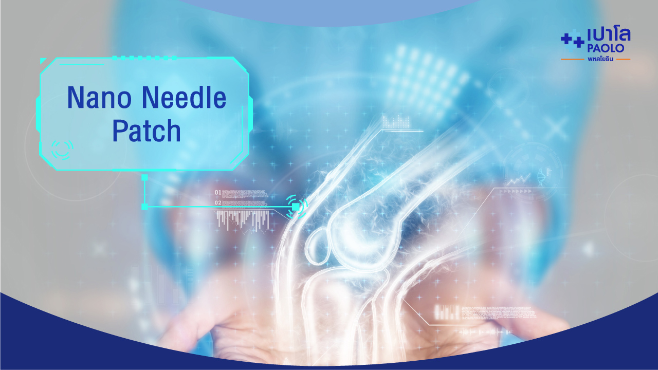 Nano Needle Patch
