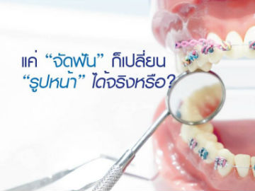 แค่ “จัดฟัน” ก็เปลี่ยน “รูปหน้า” ได้จริงหรือ?