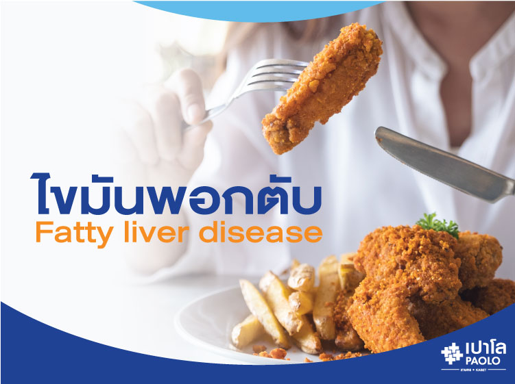 ไขมันพอกตับ (Fatty liver disease)