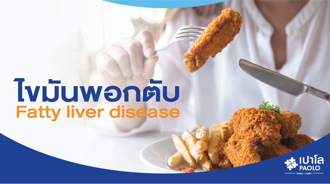 ไขมันพอกตับ (Fatty liver disease)