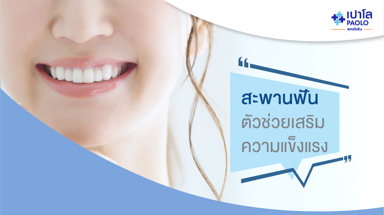 สะพานฟัน ตัวช่วยเสริมความแข็งแรง