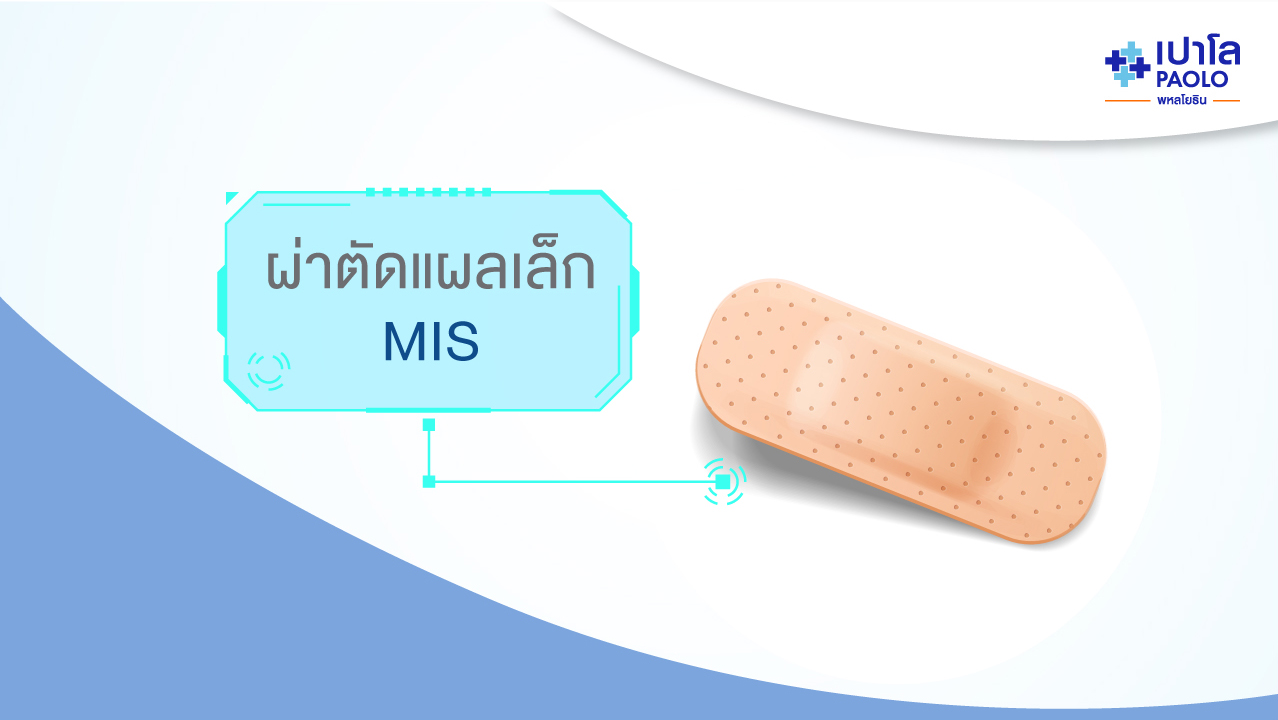 Minimal Invasive Surgery (MIS) การผ่าตัดแบบแผลเล็ก