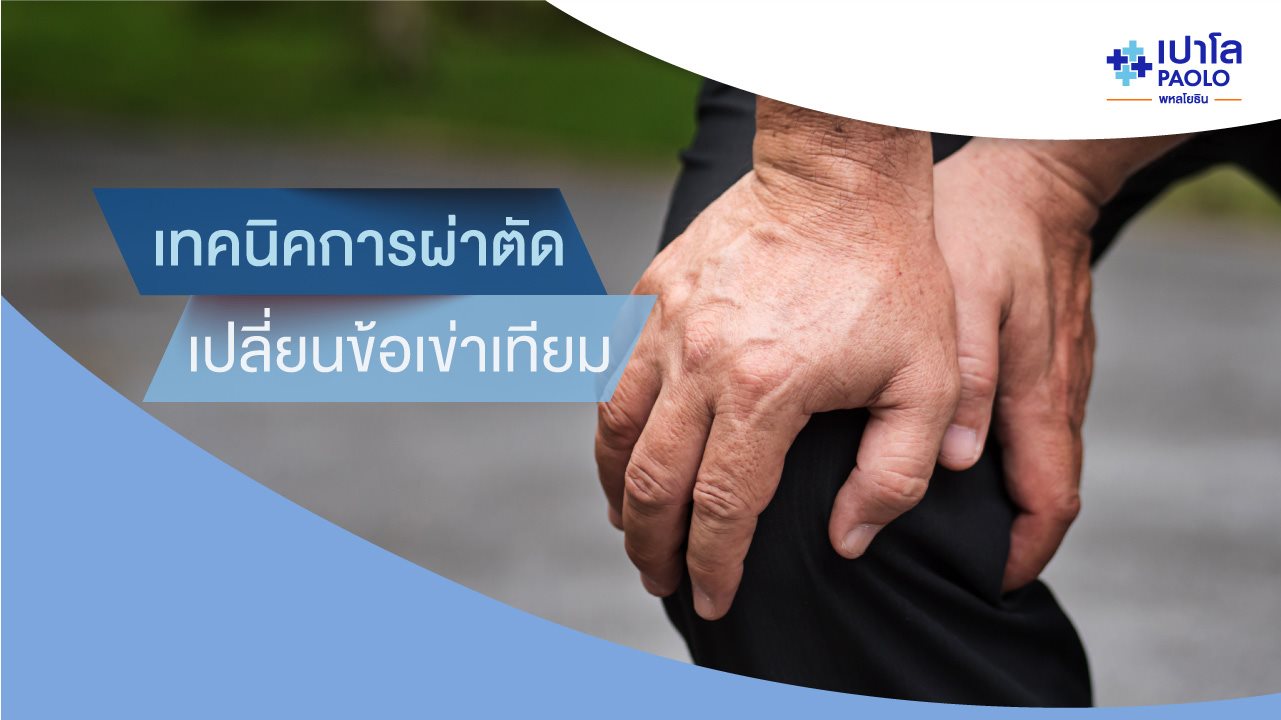 เทคนิคการผ่าตัดเปลี่ยนข้อเข่าเทียม เจ็บน้อย ฟื้นตัวเร็ว