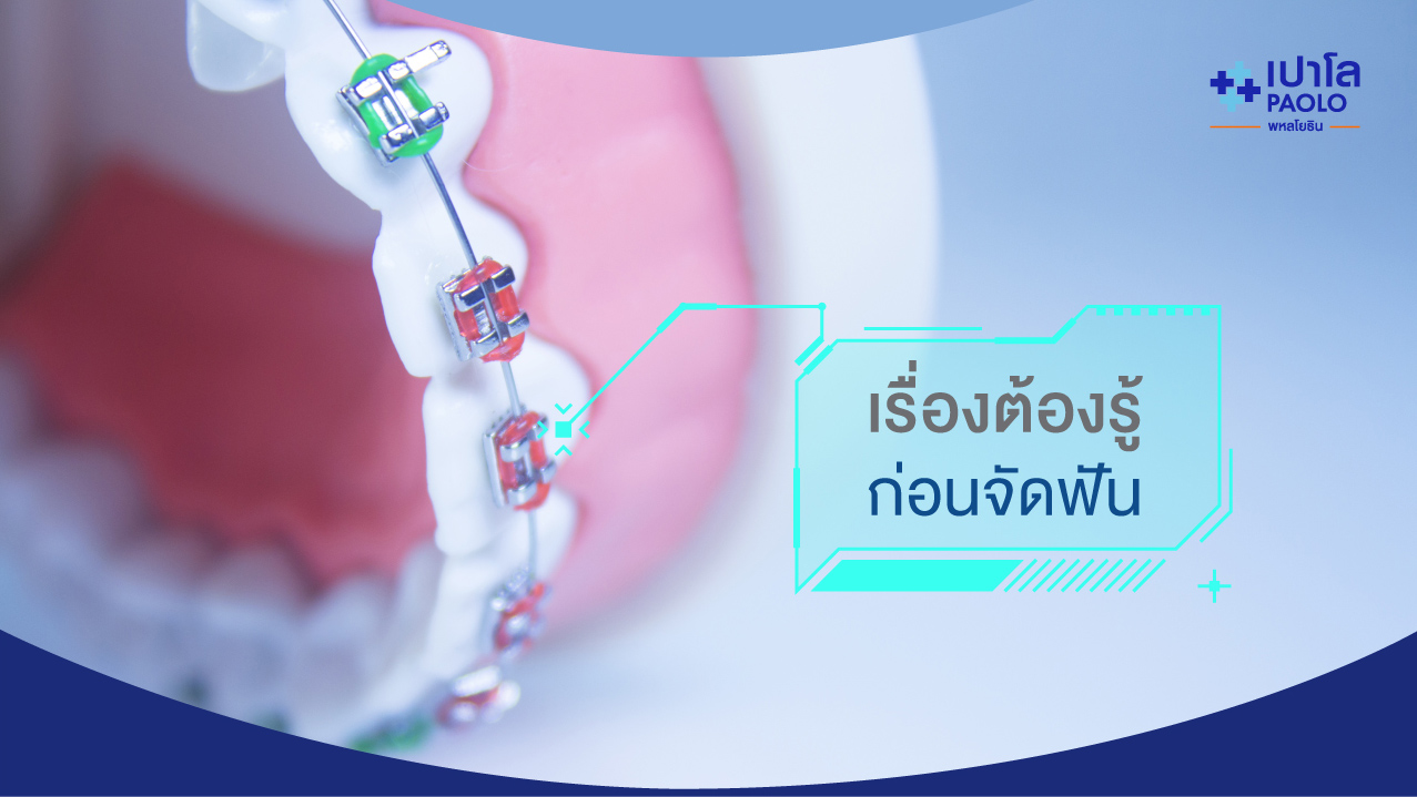 เรื่องต้องรู้ ก่อนจัดฟัน