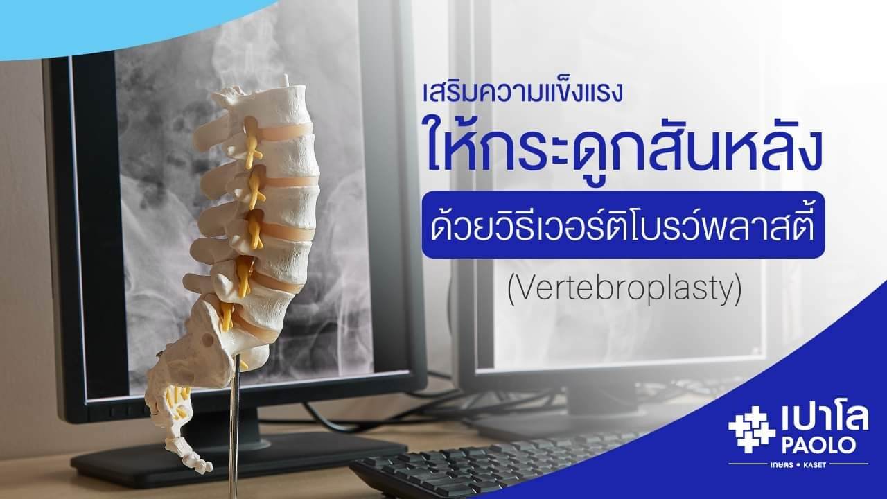 เสริมความแข็งแรงให้กระดูกสันหลัง ด้วยวิธีเวอร์ติโบรว์พลาสตี้ (Vertebroplasty)