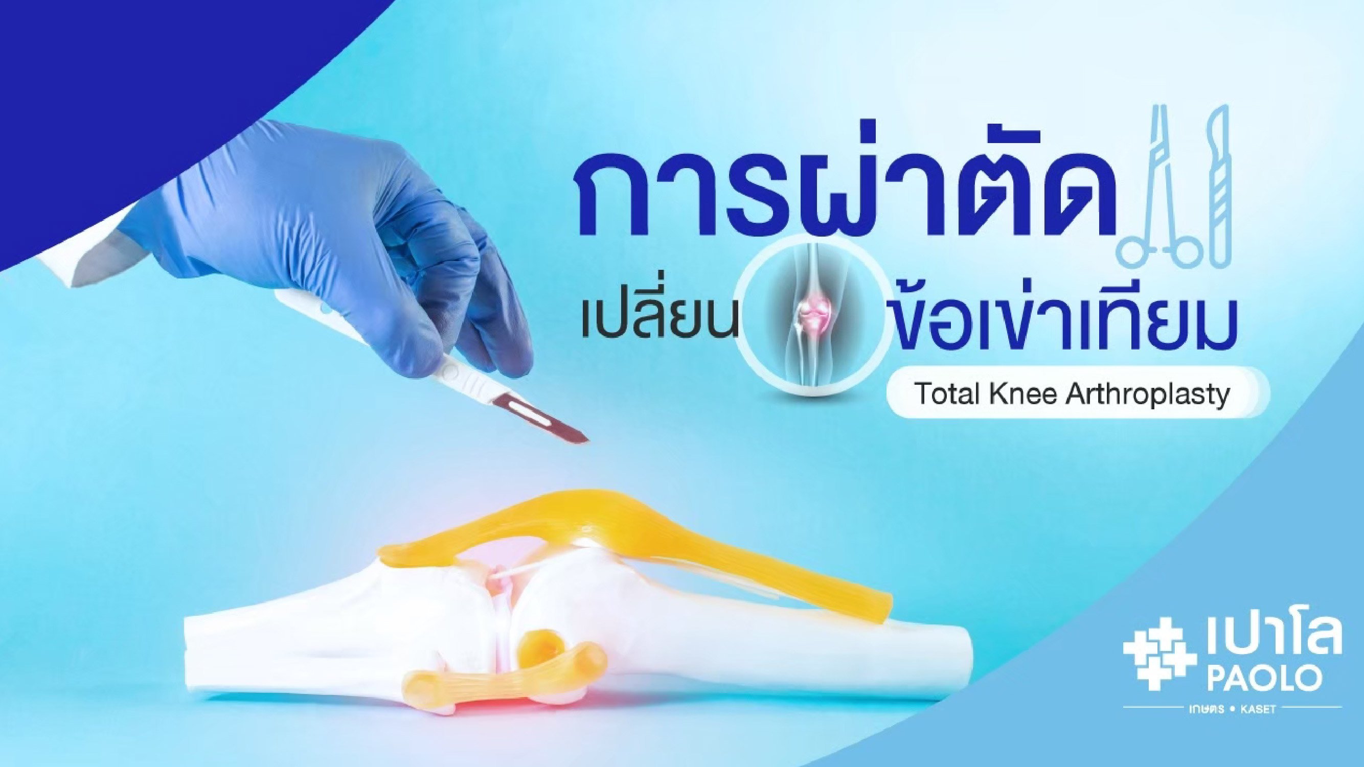 การผ่าตัดเปลี่ยนข้อเข่าเทียม Total knee arthroplasty