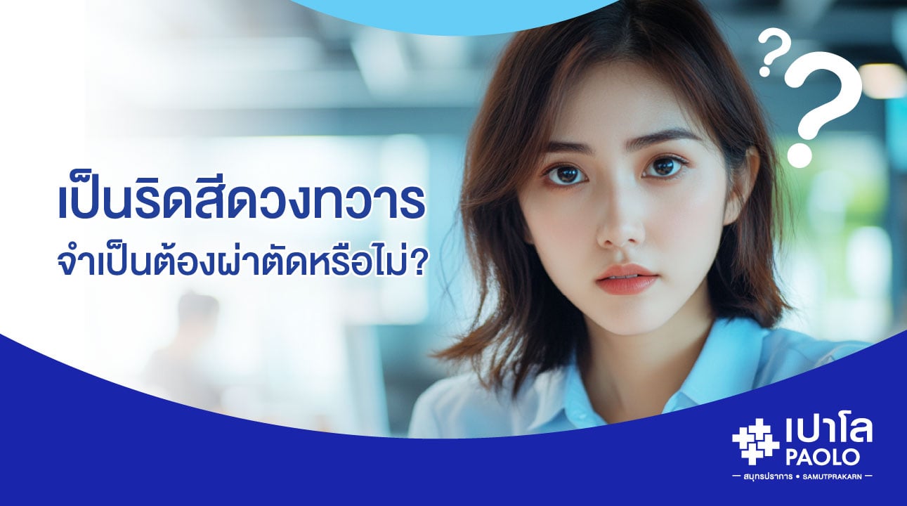 เป็นริดสีดวงทวาร...จำเป็นต้องผ่าตัดหรือไม่?