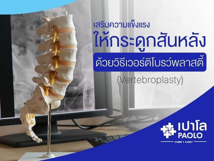 เสริมความแข็งแรงให้กระดูกสันหลัง ด้วยวิธีเวอร์ติโบรว์พลาสตี้ (Vertebroplasty)