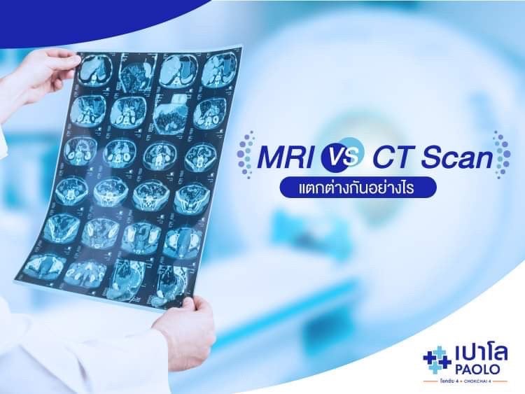 MRI กับ CT Scan แตกต่างกันอย่างไร