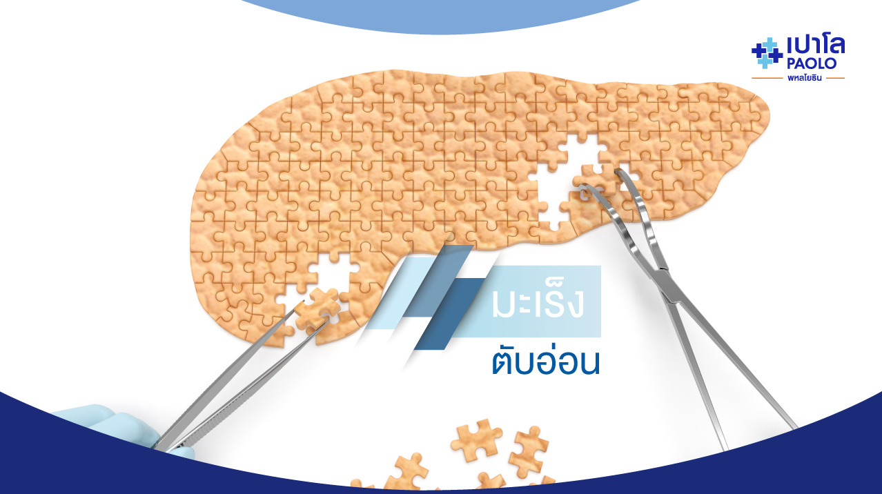 มะเร็งตับอ่อน เรื่องที่หลายคนละเลย...ผ่าตัดได้ถ้าพบระยะเริ่มต้น